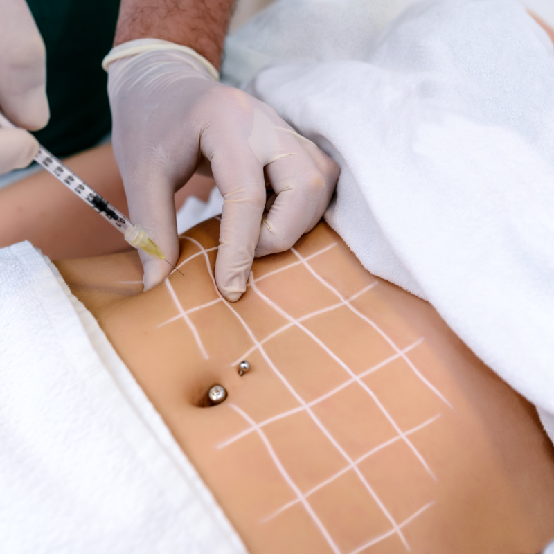 inyección abdominal