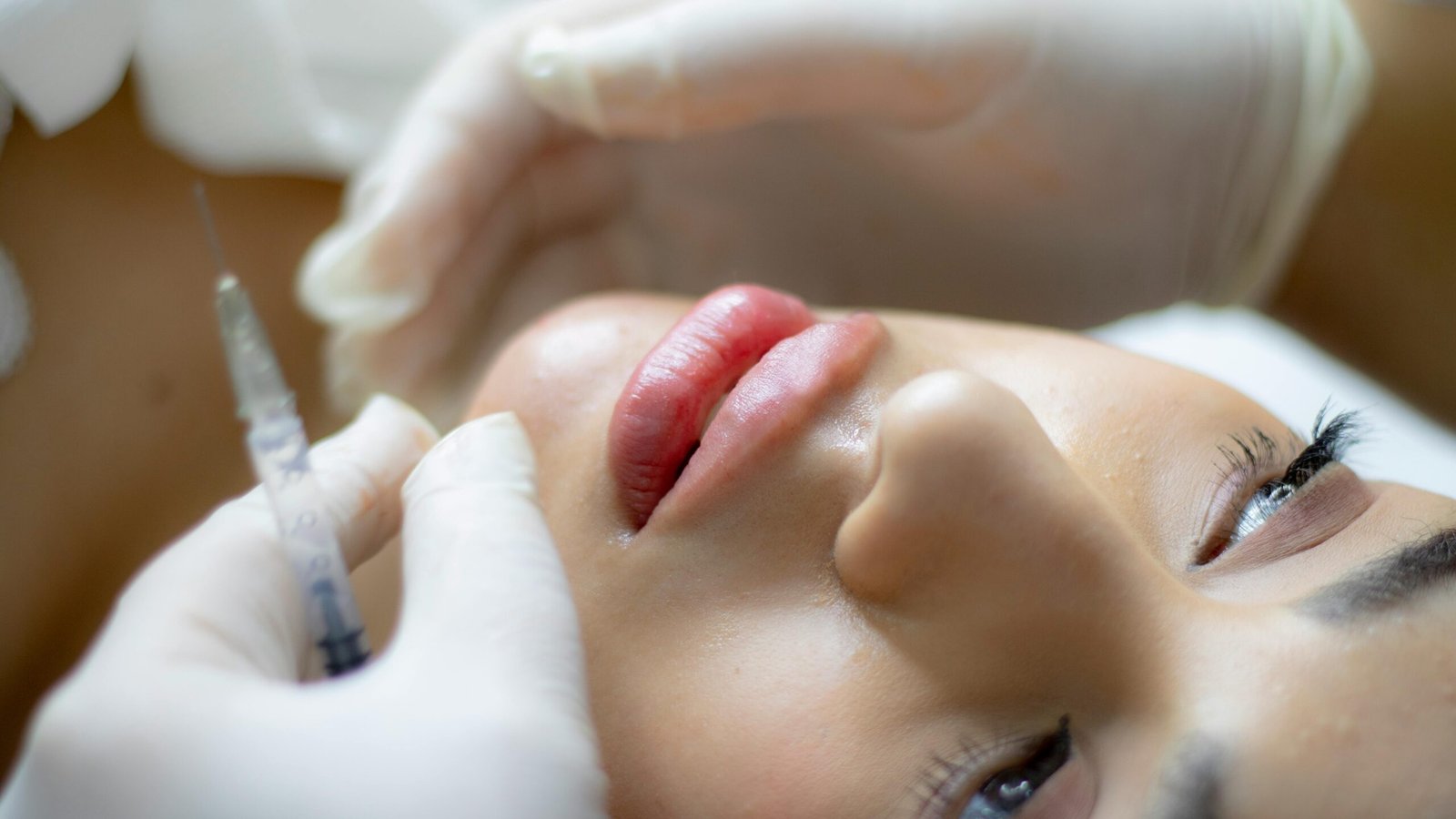 aplicación de botox en los labios